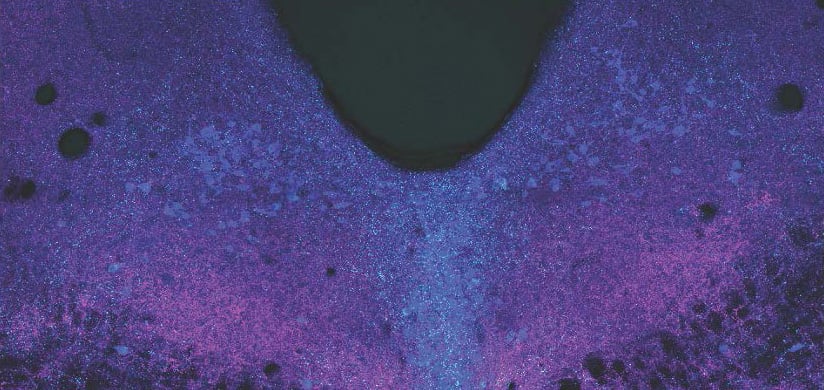 Dorsal-Raphe-Alternative-View.jpg