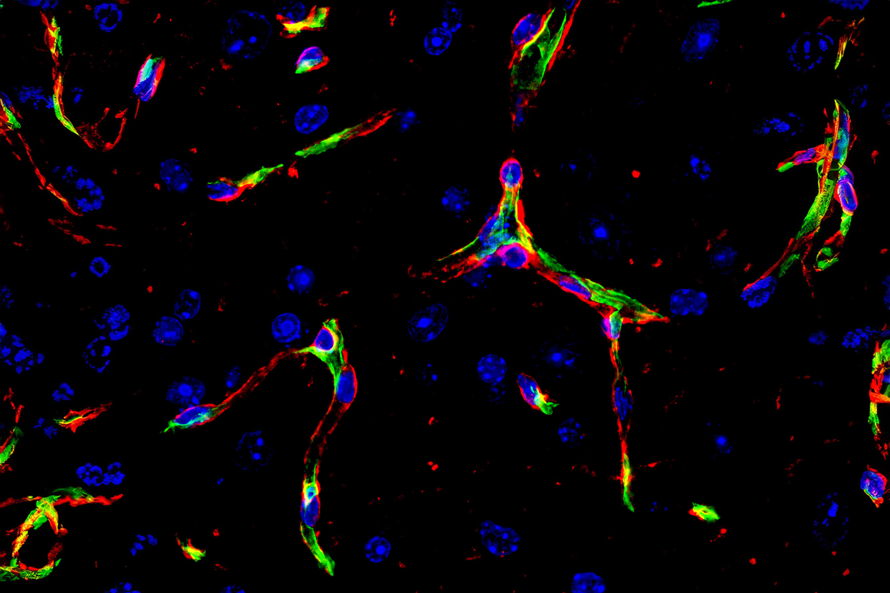 Blood-Vessel-Endothelial-Cells-and-Basement-Membrane-in-the-Brain.jpg