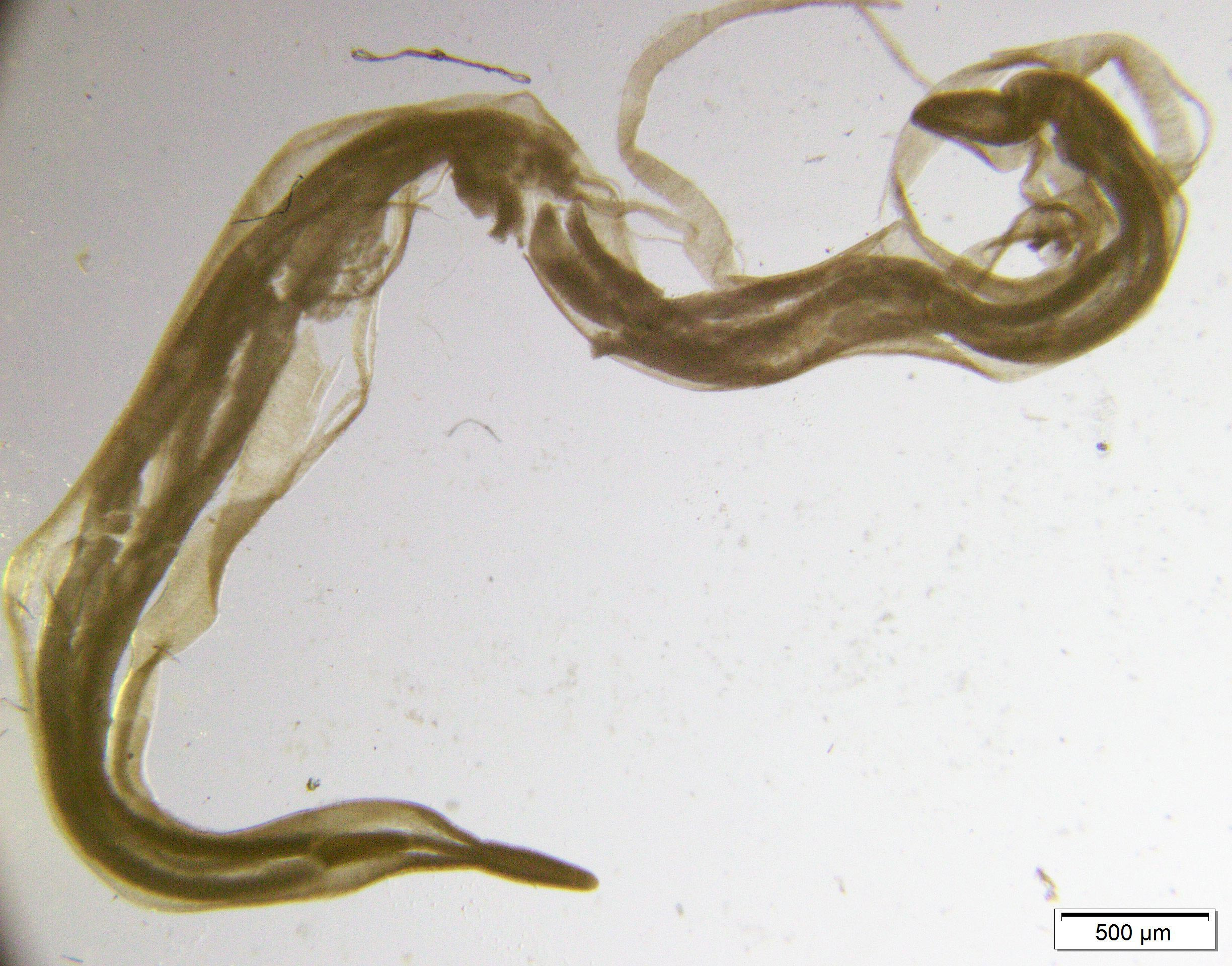 Anisakid-Worm_jpg_92.jpg