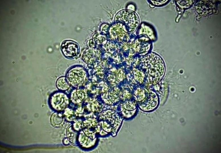 Bd-Fungus.jpg