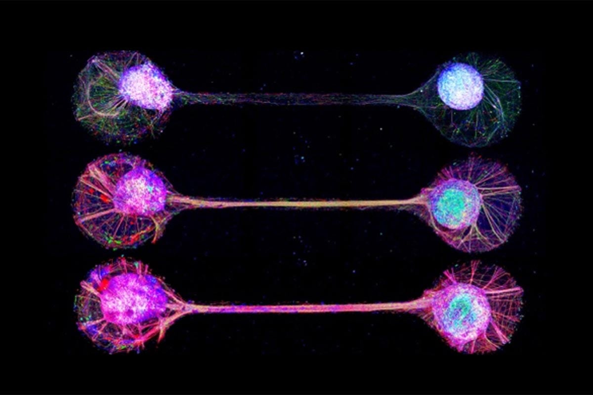 Lab-Grown-Cerebral-Organoids.jpg