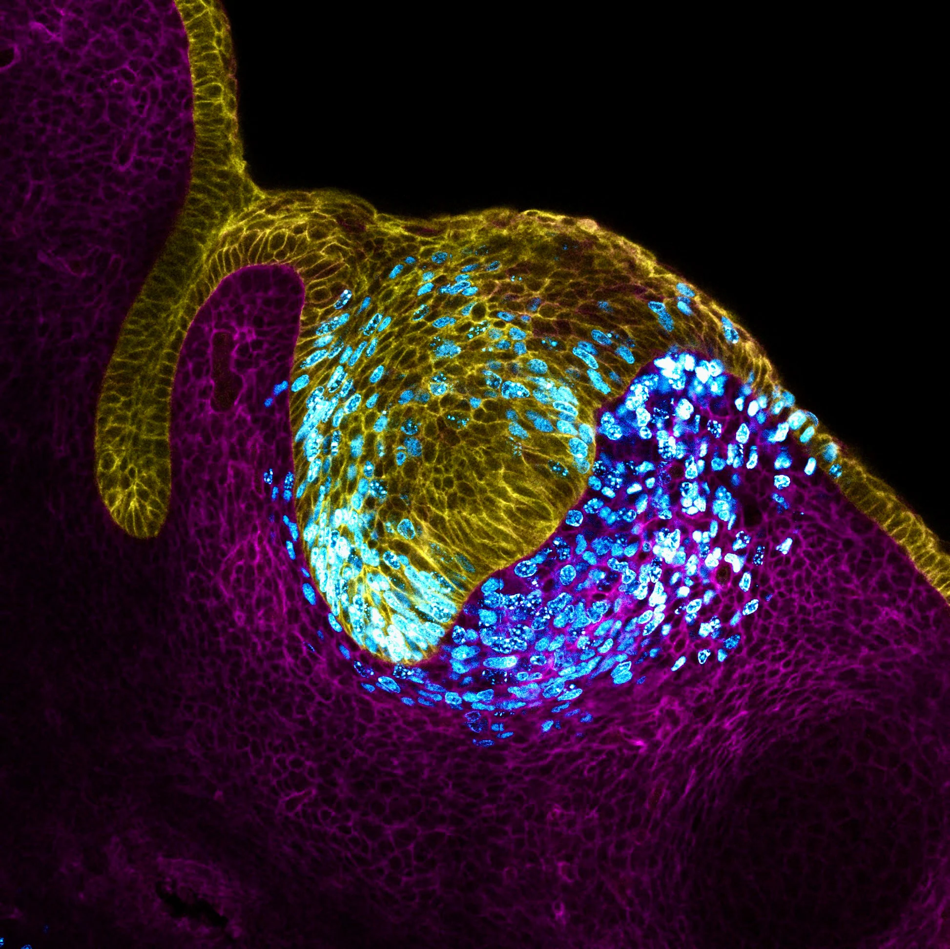 Tooth-Epithelium.webp
