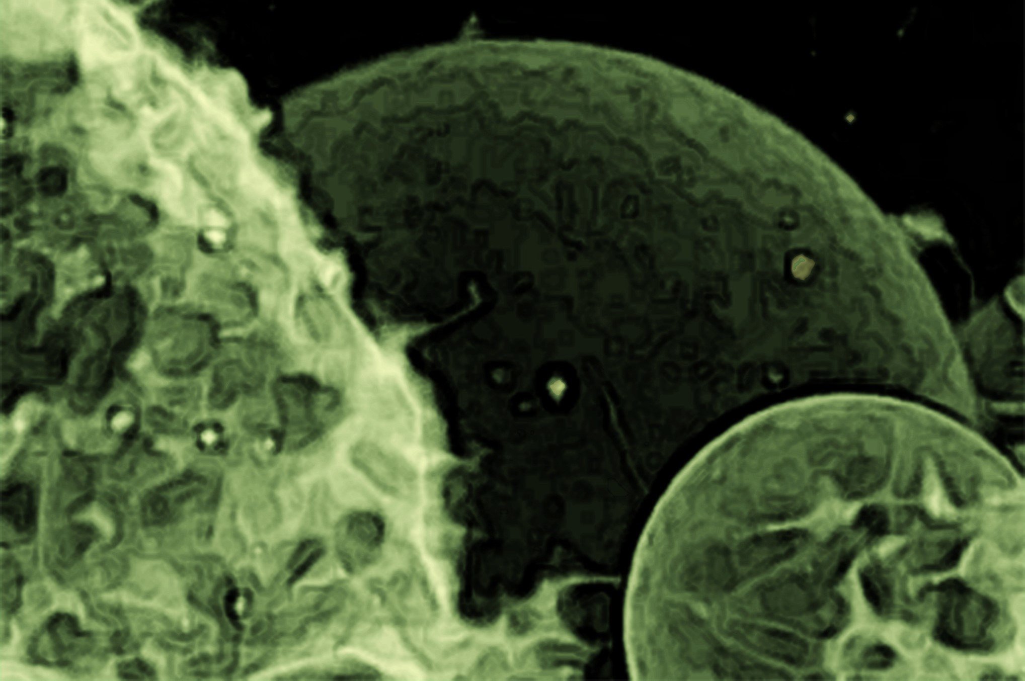 Portrait-of-Extracellular-Vesicles.jpg