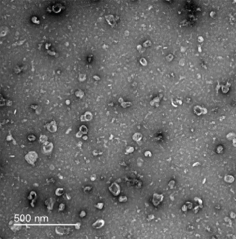 Negative-Stain-Transmission-Electron-Microscopy-Was-Used-To-Confirm-the-Isolation-of-Small-Extracellular-Vesicles-in-Mouse-Neurons.jpg