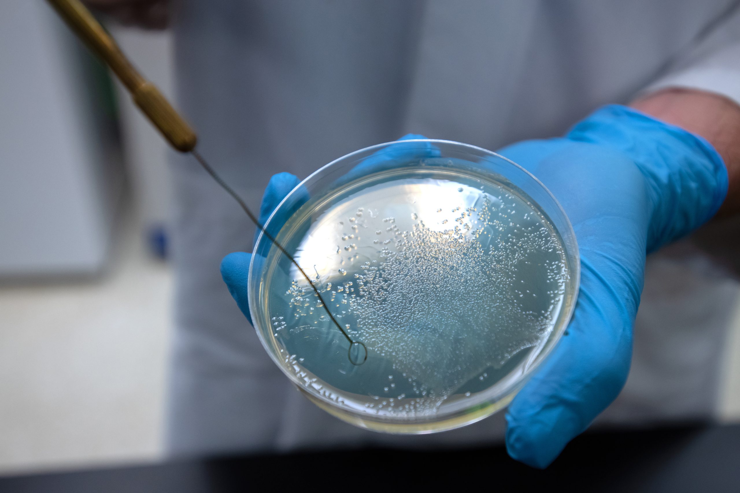 Bacteria-Petri-Dish-scaled.jpg
