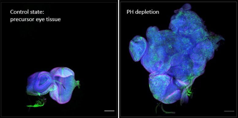 Tumor-Reducing-Expression-Levels-Polycomb-Protein.jpg