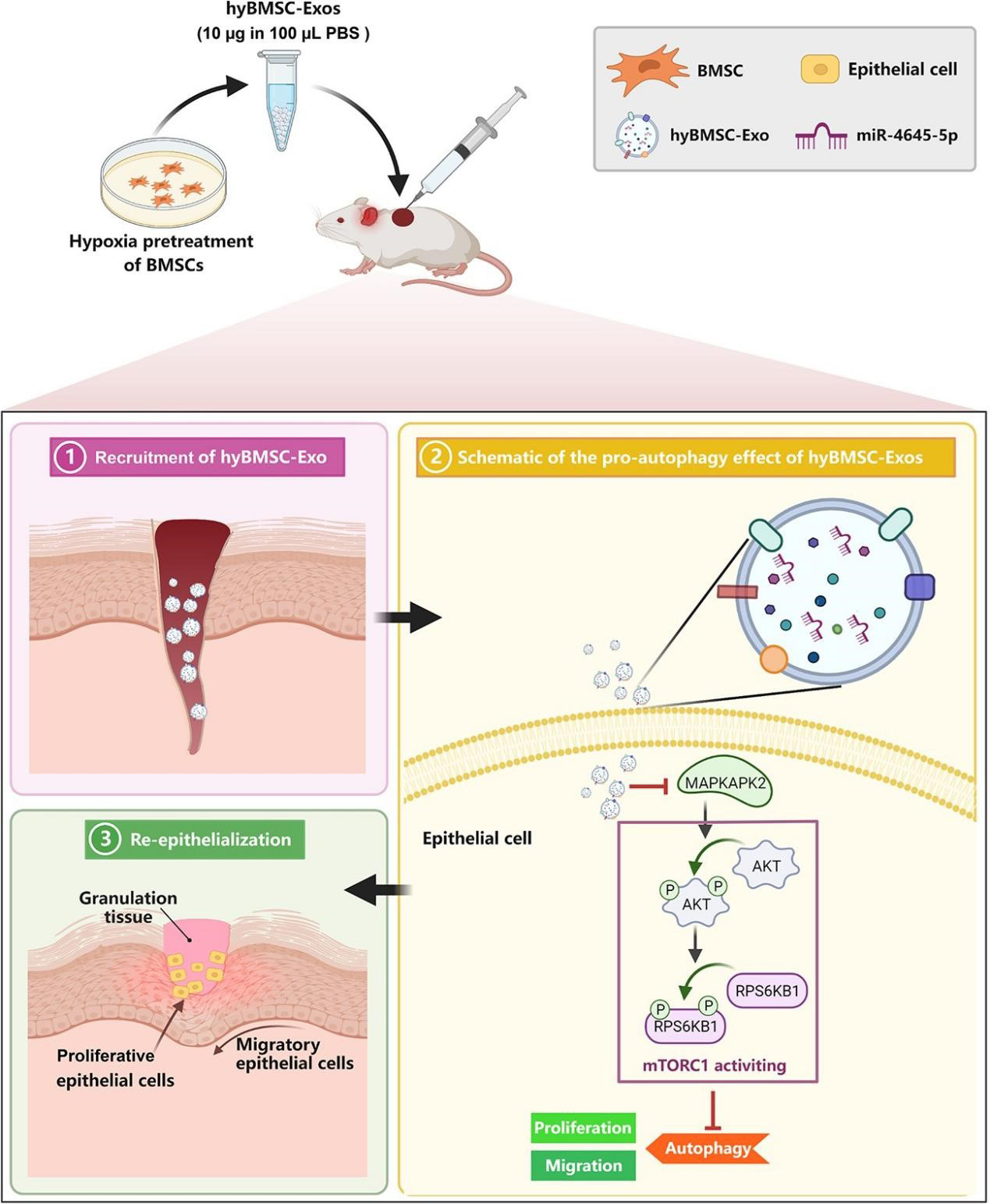 Schematic-Representation-of-the-Therapeutic-Effect-of-hyBMSC-Exos-on-Diabetic-Wounds.jpg