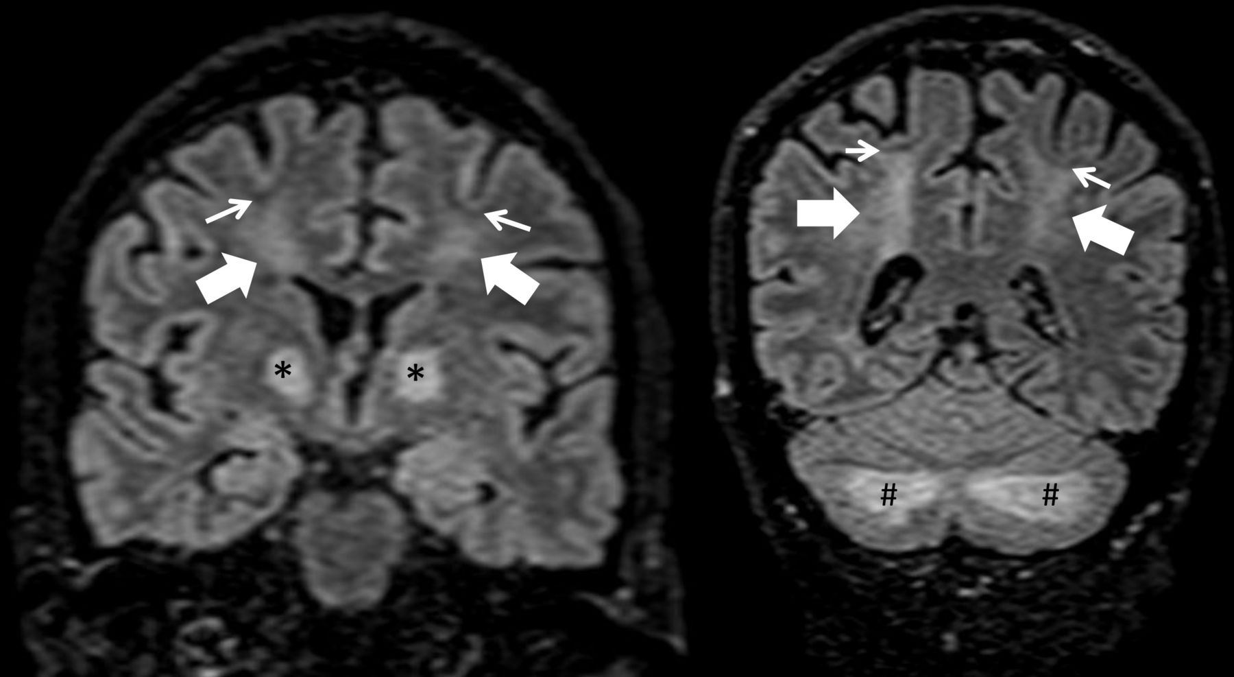 bmjcr-2024-April-17-5--F4.large.jpg