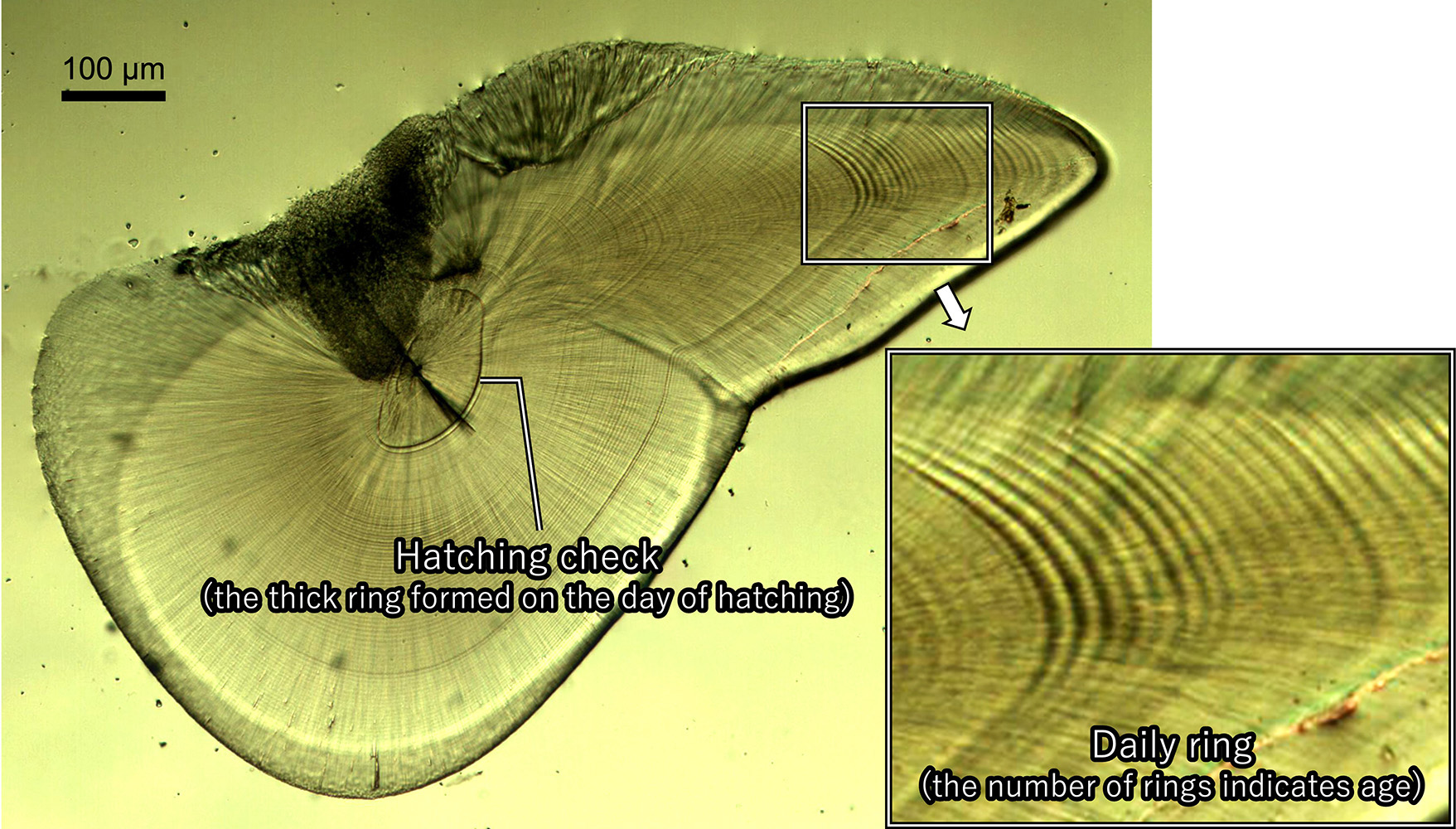 Statolith-Growth-Rings.jpg
