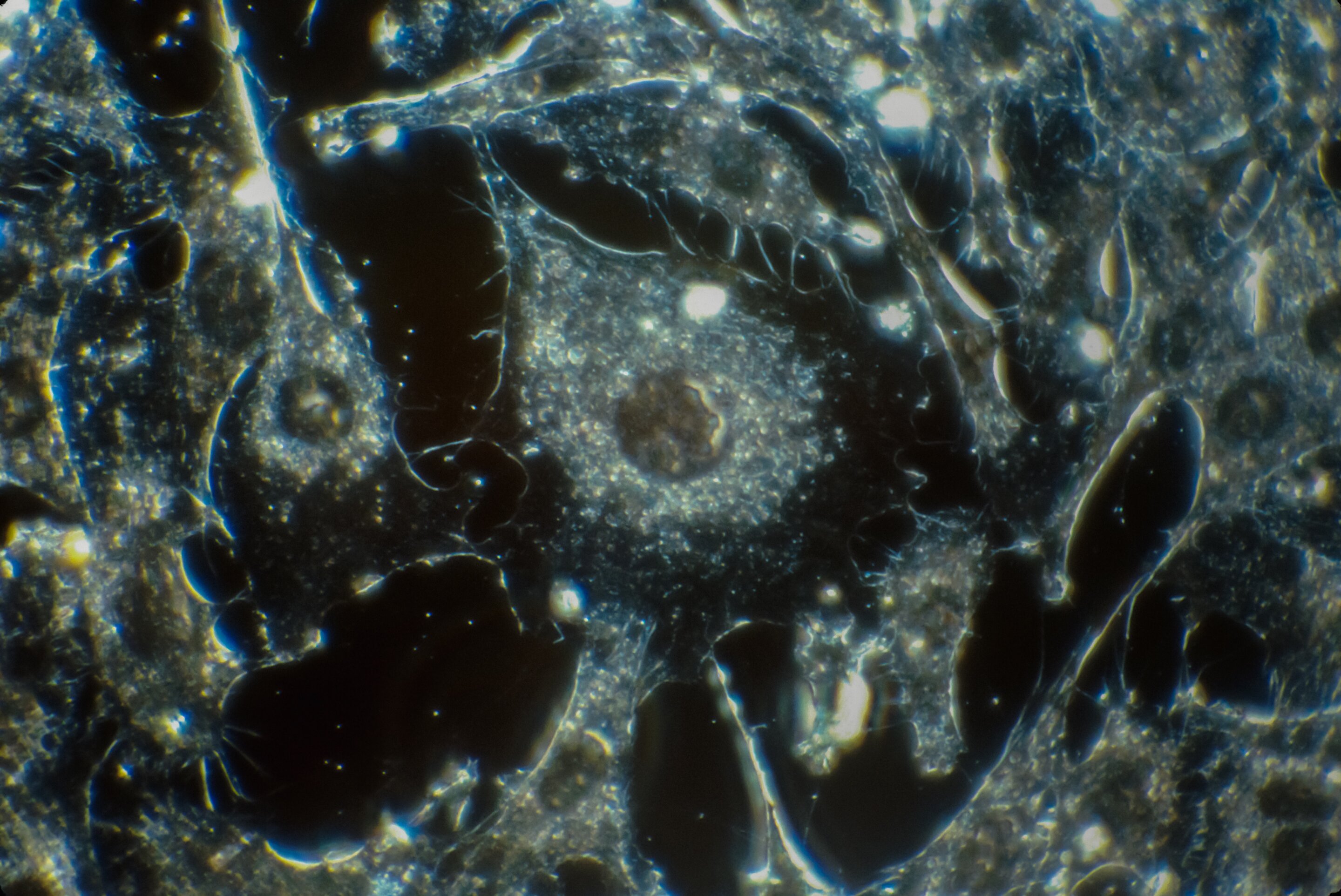 cancer-cells.jpg