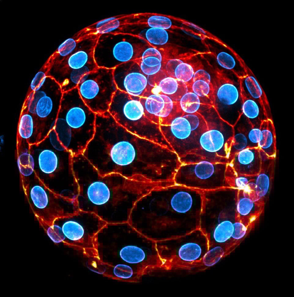 Cell-Contraction-Drive-the-Initial-Shaping-of-Human-Embryos.jpg