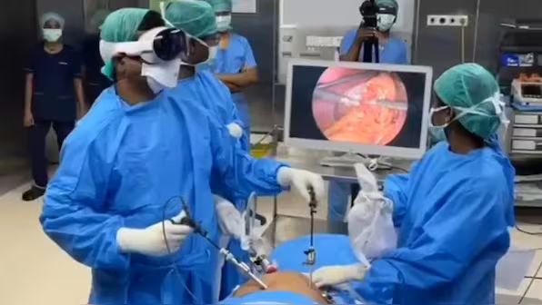 The-big-picture-How-a-Chennai-based-doctor-used-Vision-Pro-to-perform-30-complex-surgeries-2024-05-499cb889f18b56f612dd902f70447b9a-1200x675.avif（AVIF 图像，596x336 像素）.jpg