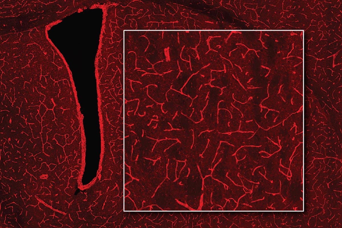 Detect-Bioluminescence-Brain-Magnetic-Resonance-Imaging.jpg