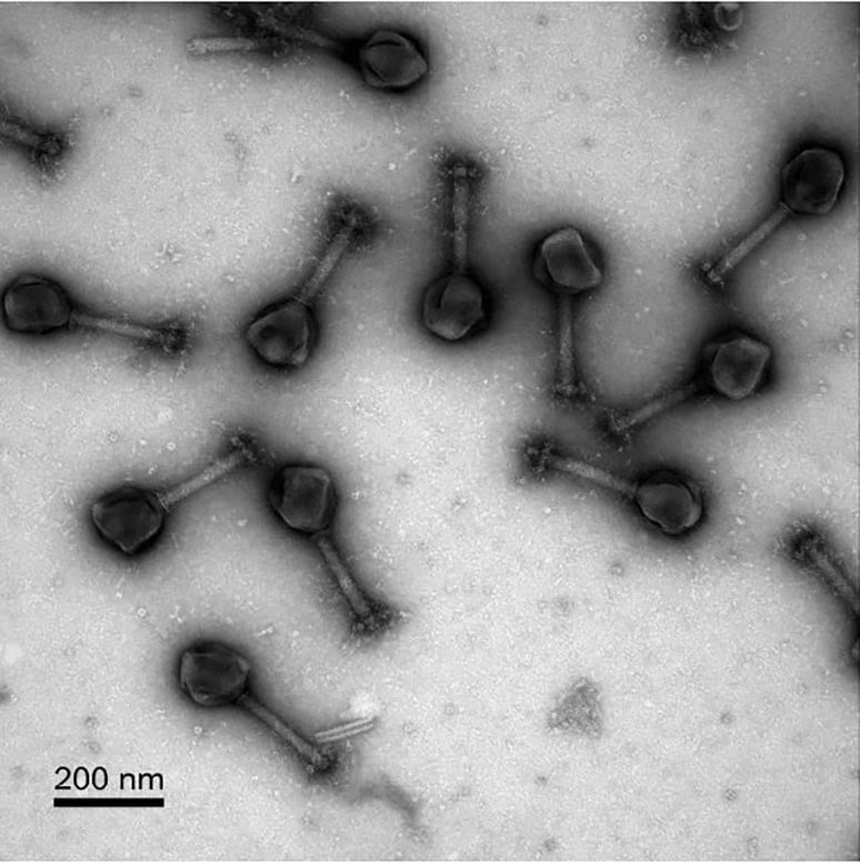 PhiKZ-Phage.jpg