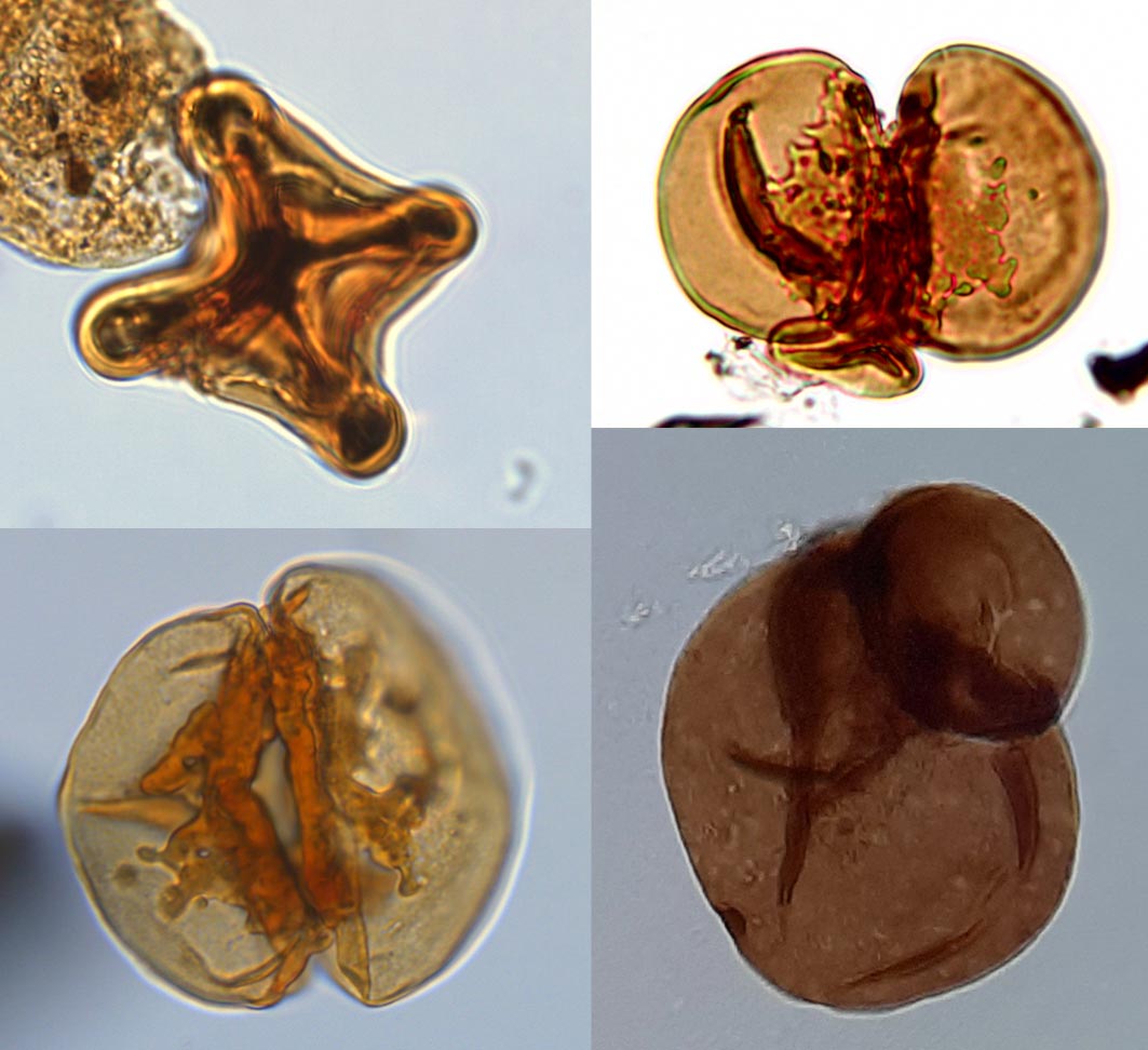 Malformed-and-Teratologic-Spores.jpg