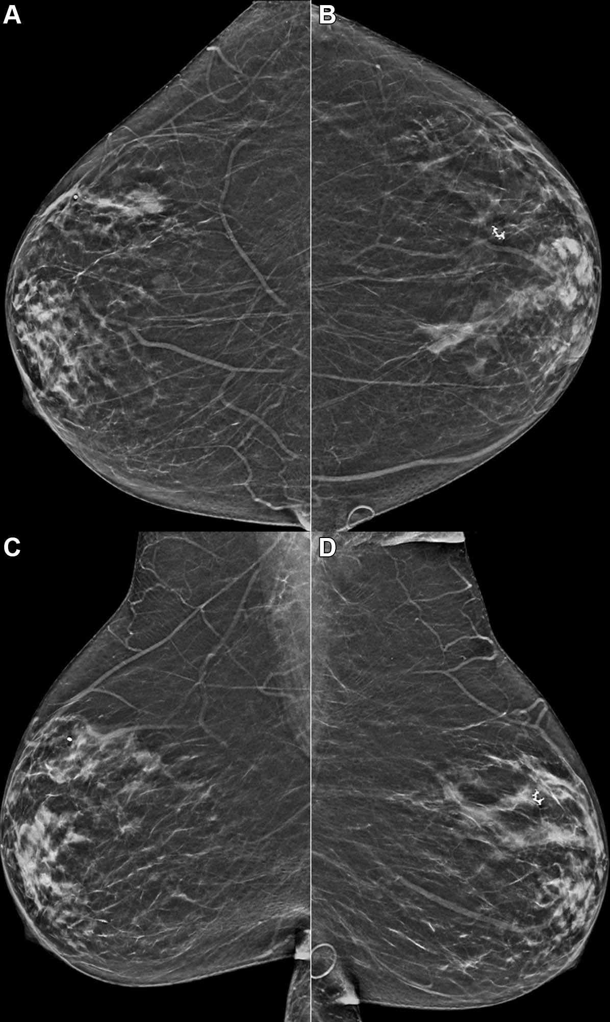 Example-Mammogram-Assigned-False-Positive-Risk-Score.jpg