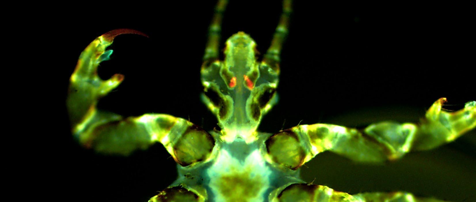 Human-Body-Louse-With-Yersinia-pestis-Infection.jpg