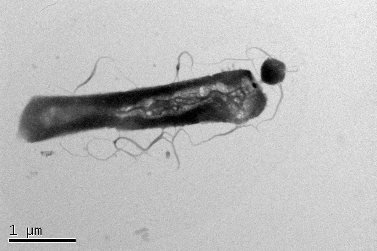 Parasitic-Archaea-Attached-to-Host.jpg