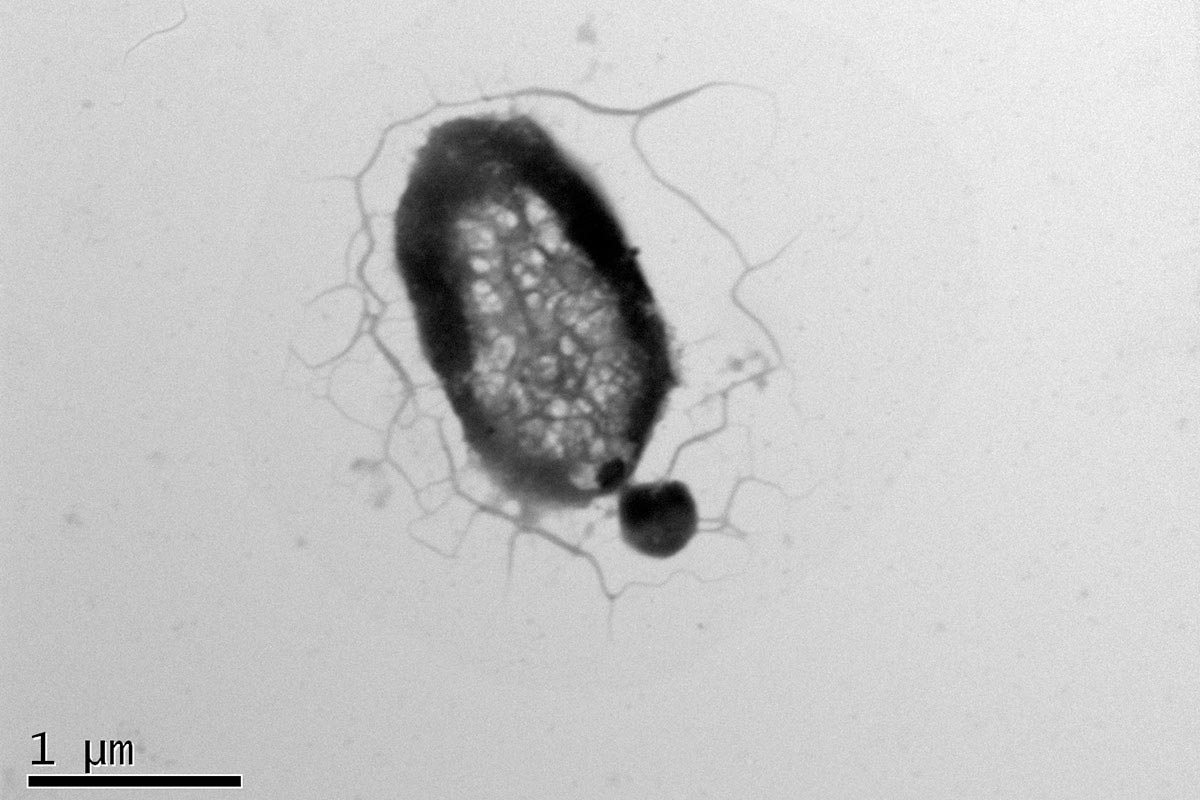 Parasitic-Archaea-Attached-to-Host-1.jpg