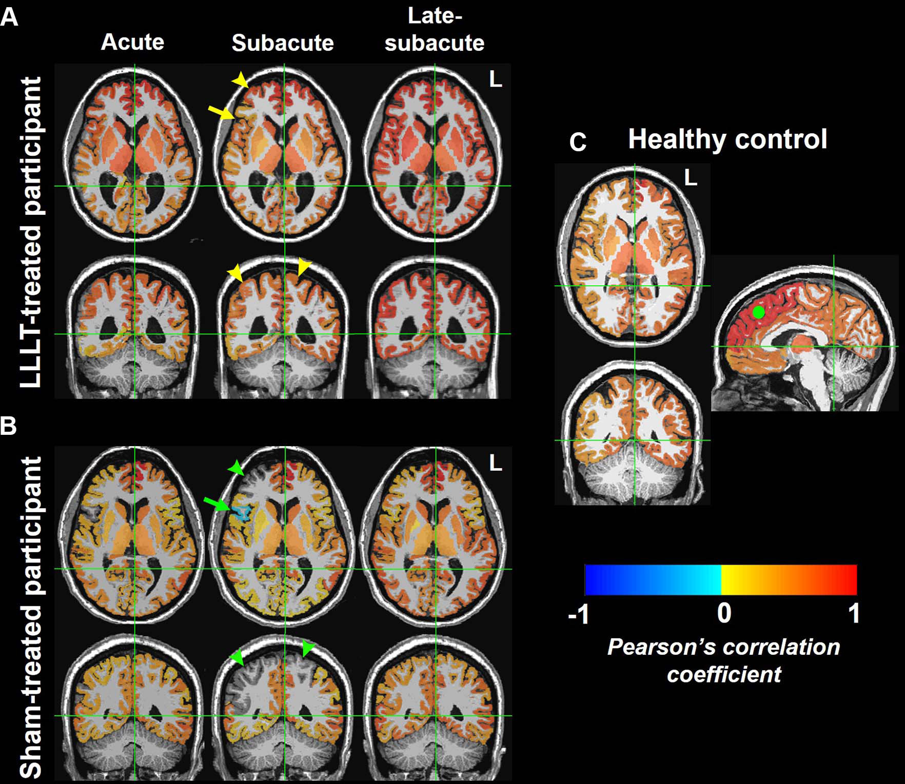 Functional-MRI-Brain-Maps-of-Resting-State-Functional-Connectivity.jpg