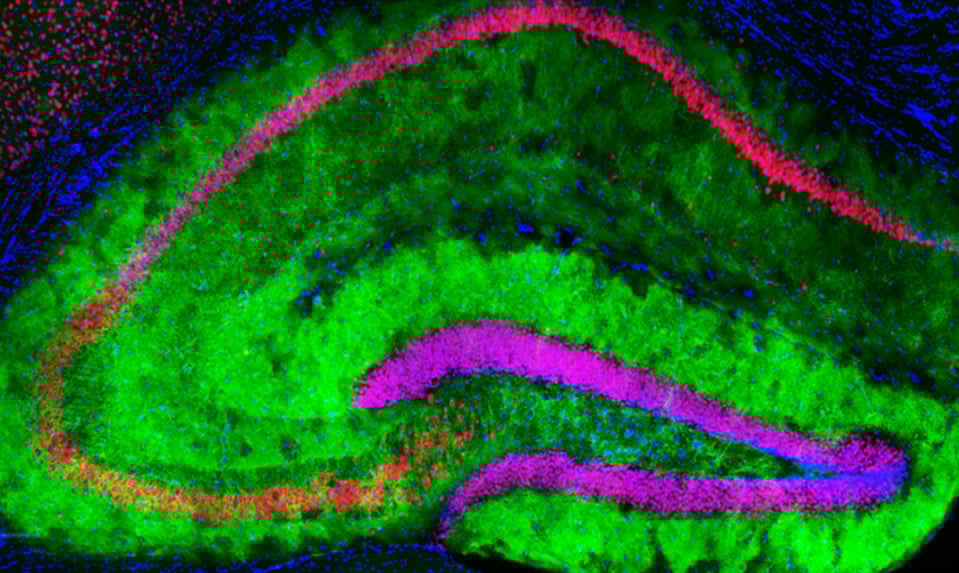 Mouse-Hippocampus.jpg