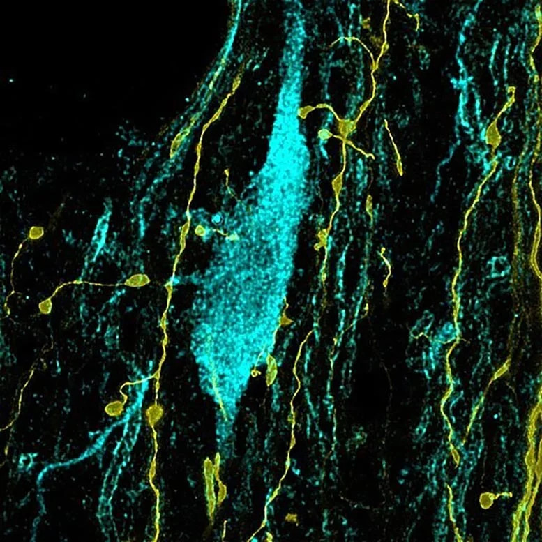 Parvalbumin-Expressing-Axons-Contacting-a-Cholinergic-Neuron_jpg_92.jpg