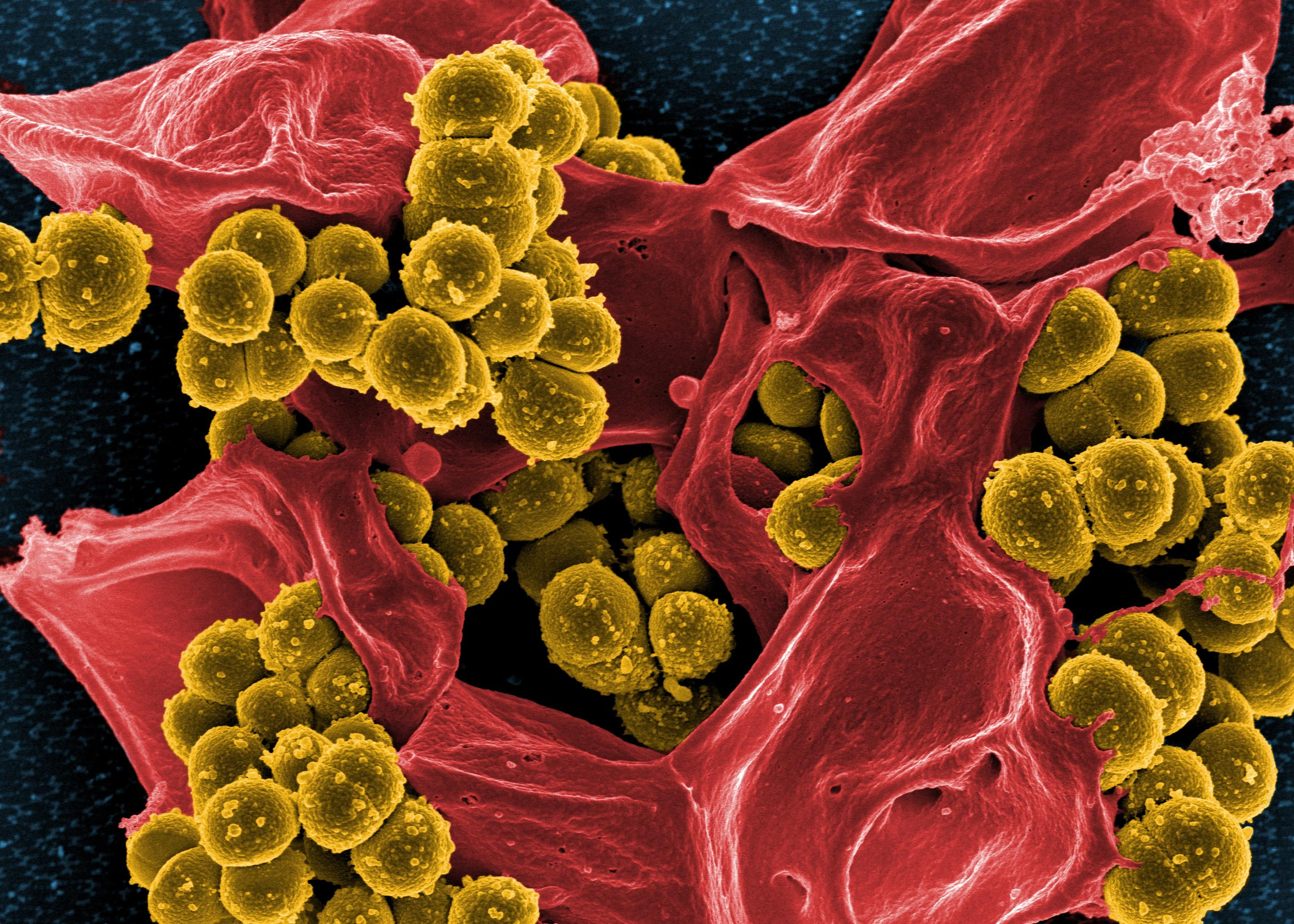 Staphylococcus-aureaus_jpg_92.jpg