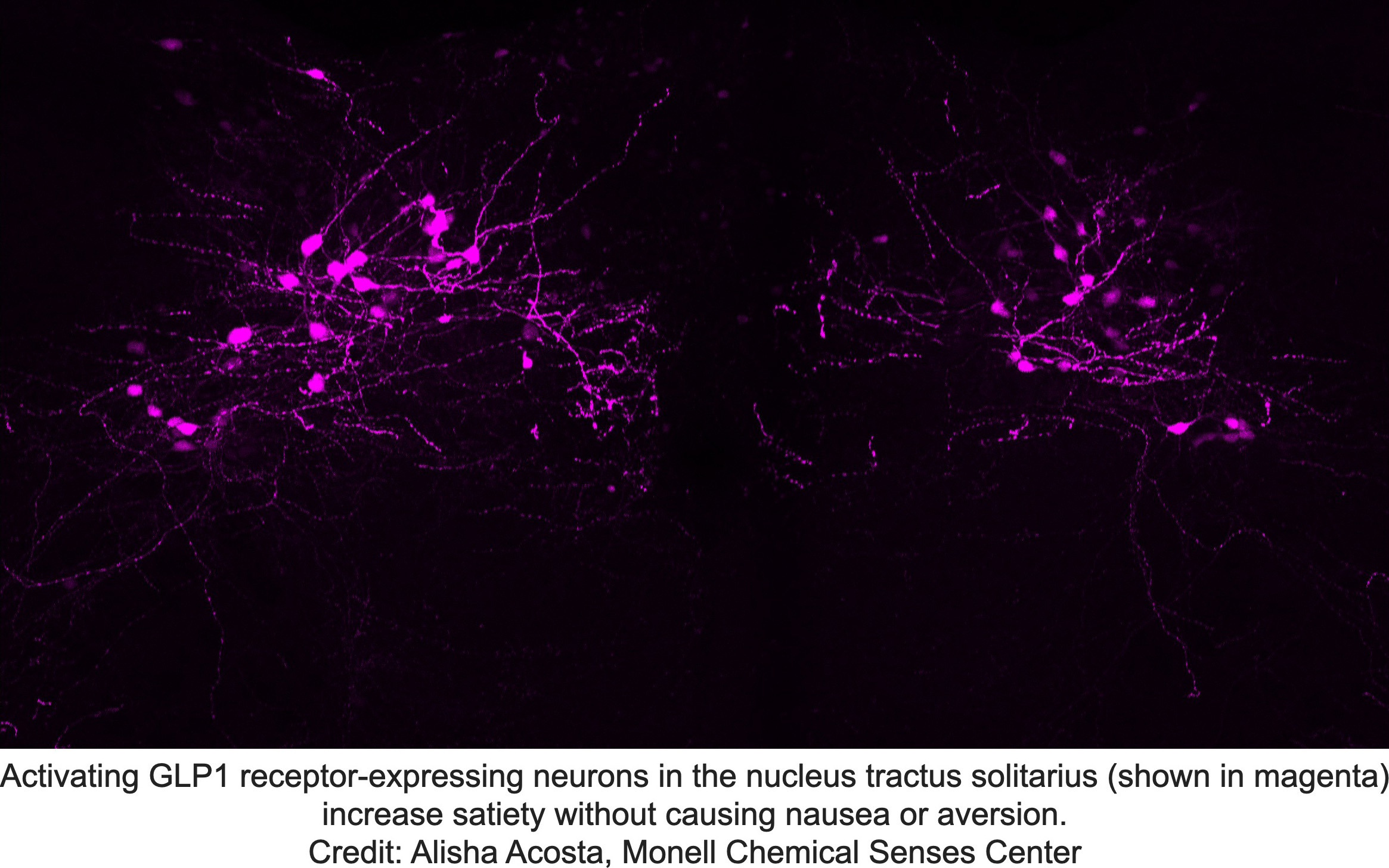 GLP1-Receptor-Expressing-Neurons_jpg_92.jpg