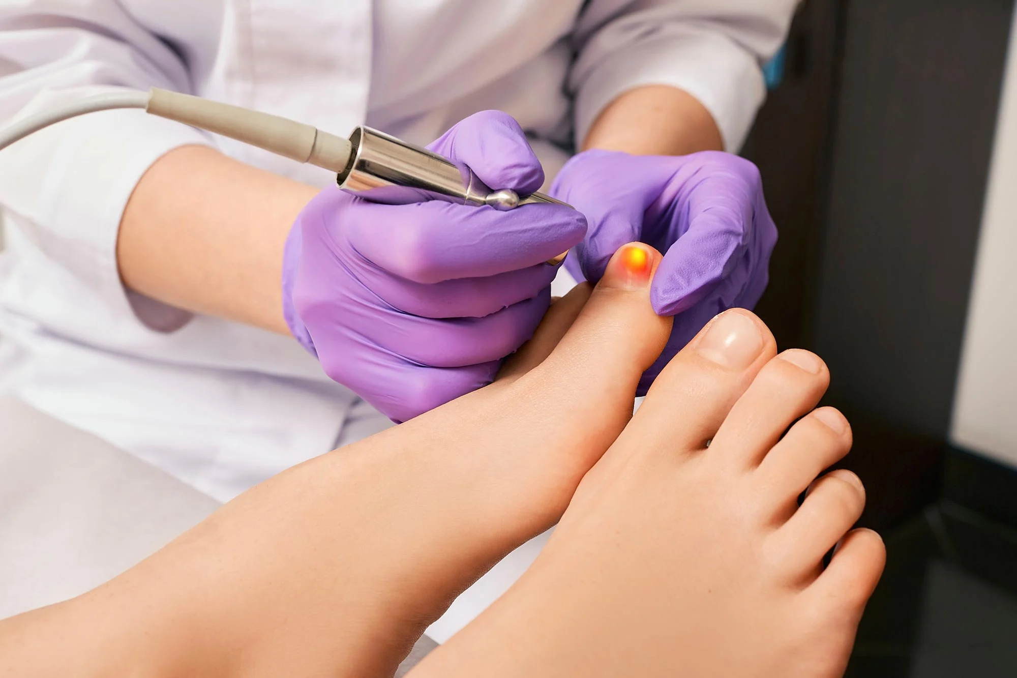 Fungal-Toe-Nail-Infection-Laser-Treatment-Crop_jpg_92.jpg