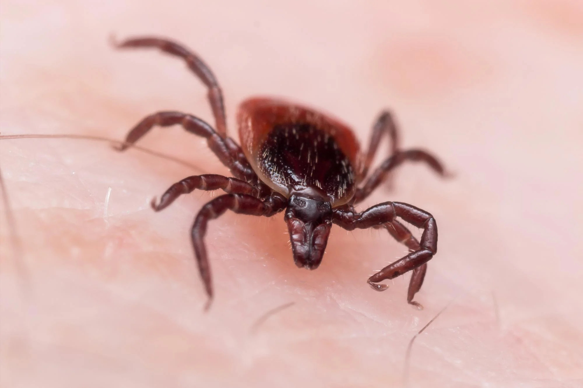 Deer-Tick-on-Skin-Lyme-Disease_jpg_92.jpg