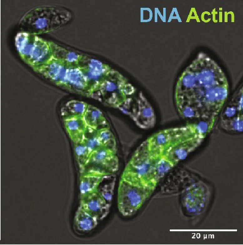 Amoebidium-appalachense-Cells_jpg_92.jpg