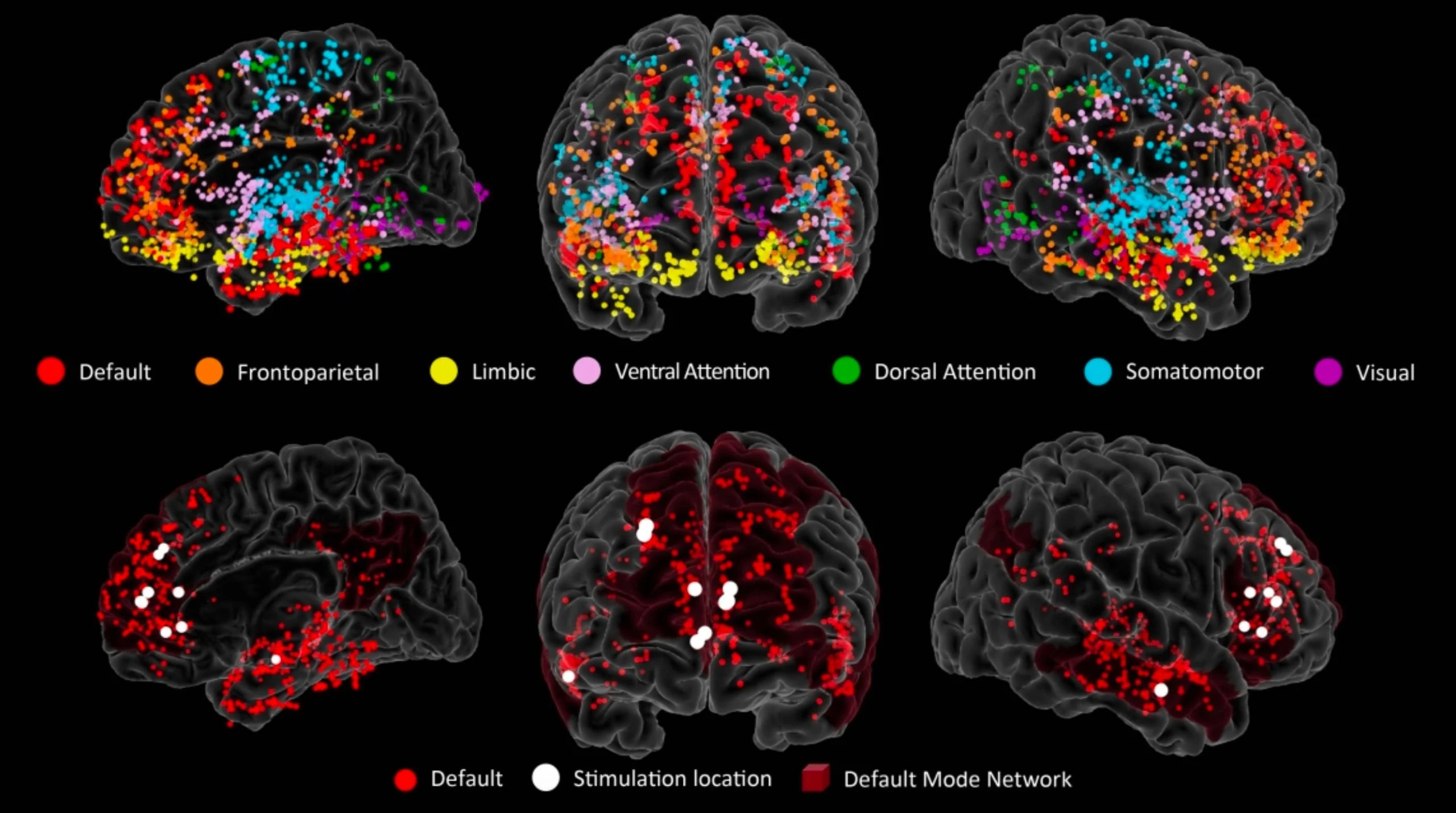 Brain-Electrode-Map-scaled_jpg_92.jpg