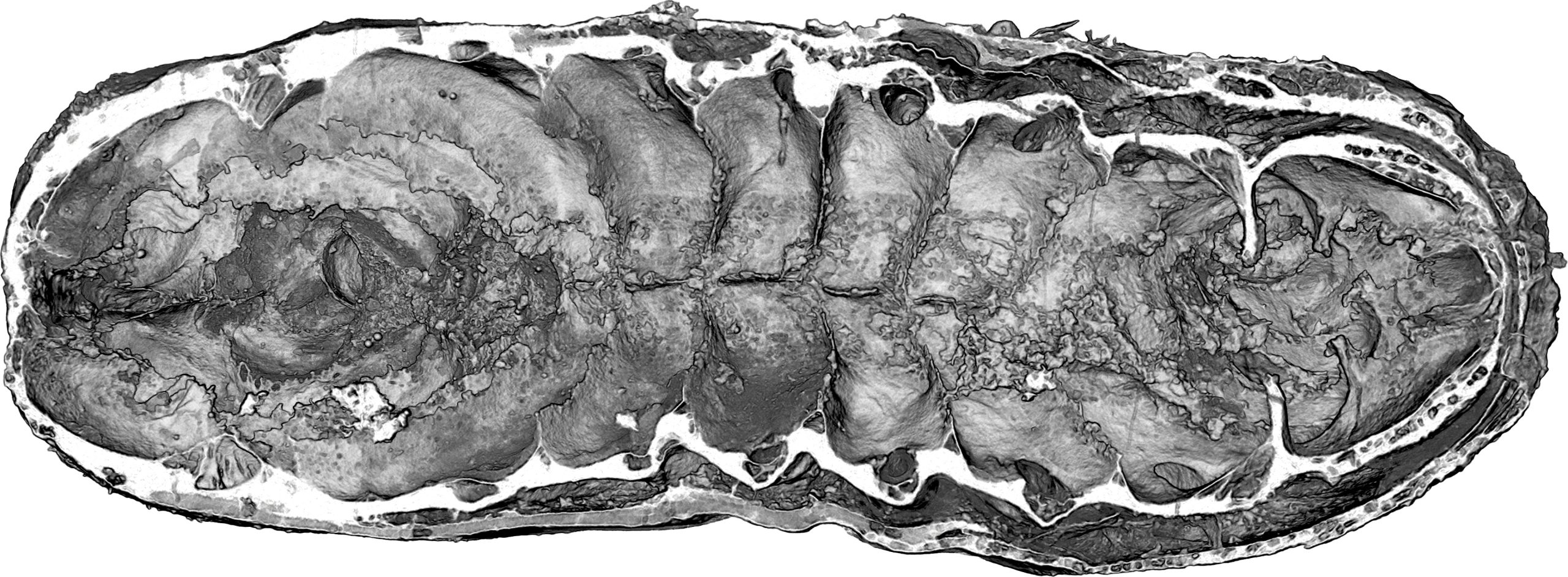 Virtual-Dissection-of-Youti-yuanshi-scaled.jpg