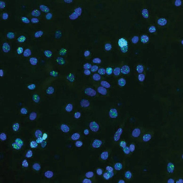 DNA-Damage-in-Human-Breast-Cancer-Cells_jpg.jpg