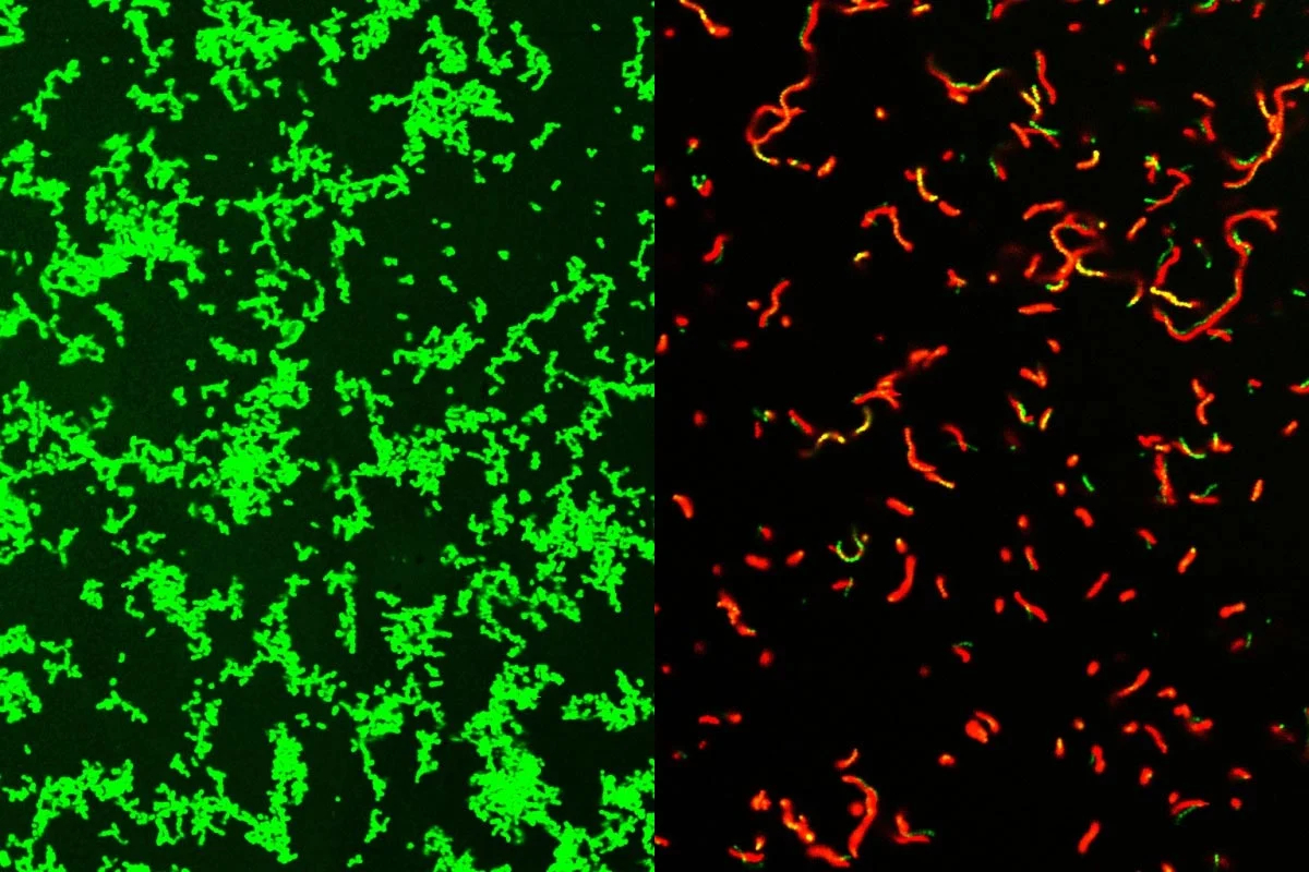 Streptococcus-pyogenes-Treated-With-GmpCide_jpg.jpg