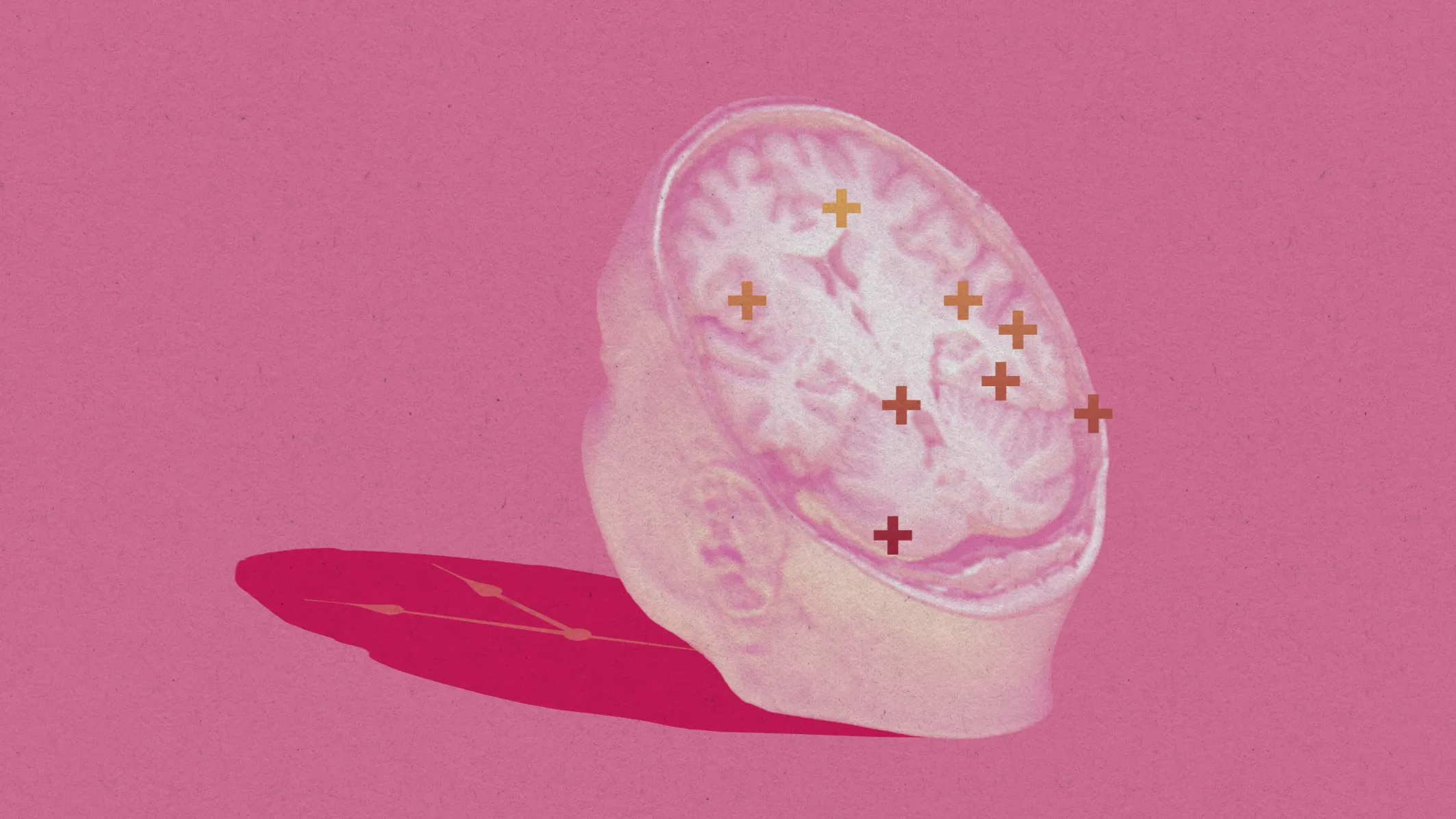 brain-replacement.webp