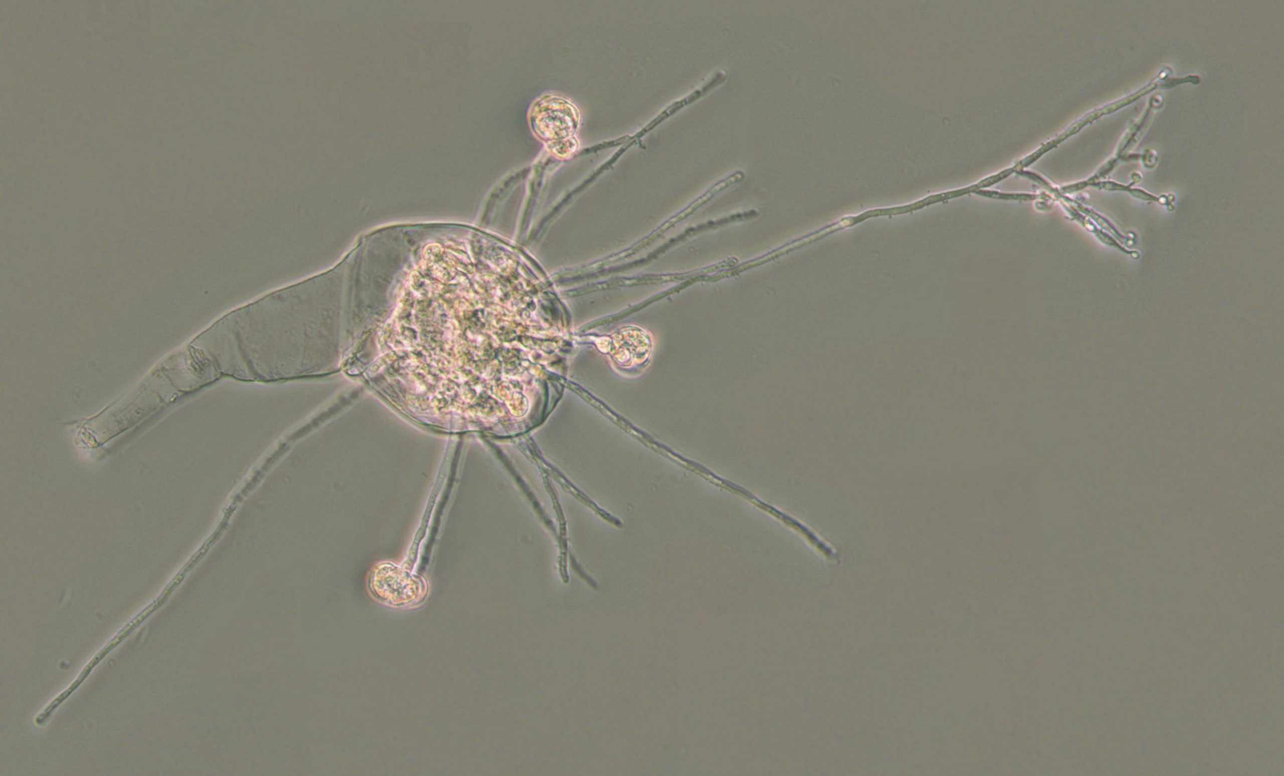 Infected-Bdelloid-Rotifer-scaled.jpg