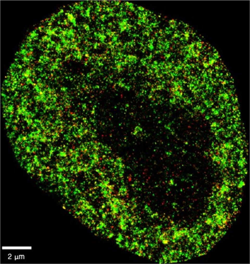 HeLa-Cancer-Cell-Super-Resolution-Image.jpg