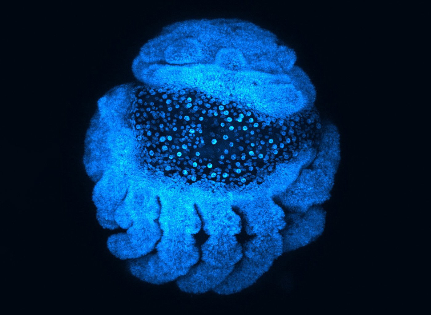 Spider-Embryo-Loss-Waist-Region.jpg