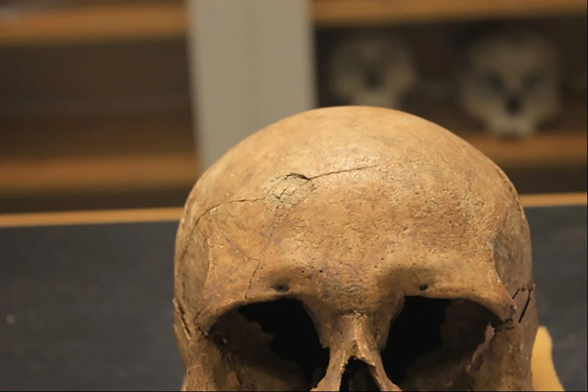 Viking-Skull-With-Blunt-Force-Trauma（WEBP 图像，1200x799 像素）.jpg