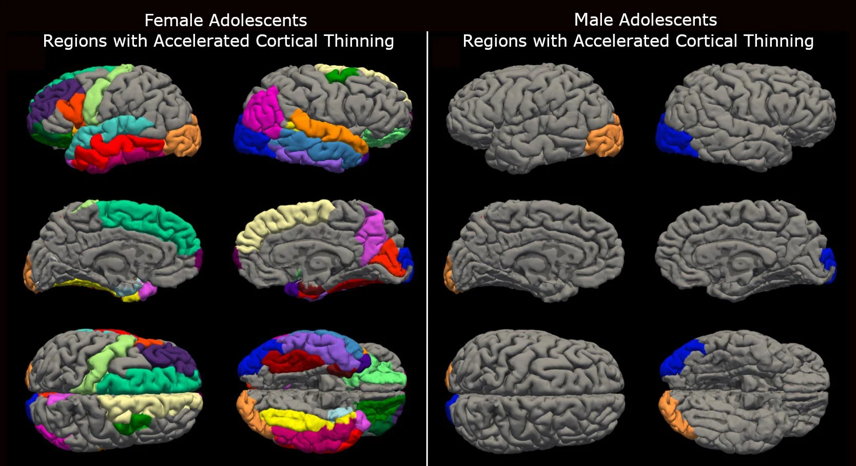 COVID-19-Lockdowns-and-Teenage-Brains（WEBP 图像，1668x908 像素） — 缩放 (85-.jpg