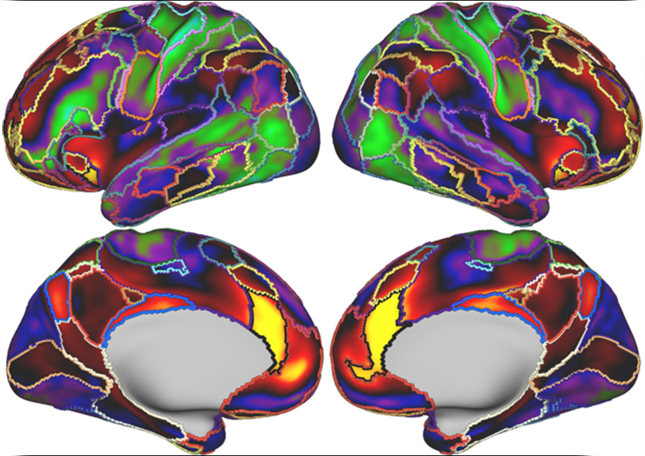 Four-Views-of-a-Persons-Brain-Showing-Boundaries-Between-Different-Functional-Brain-Networks.jpg