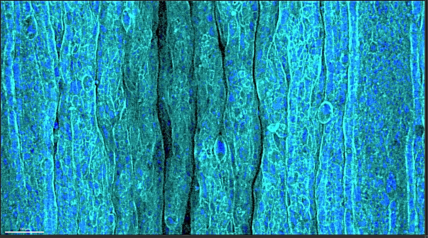 Wrinkled-Epithelium-Hydrogel.jpg