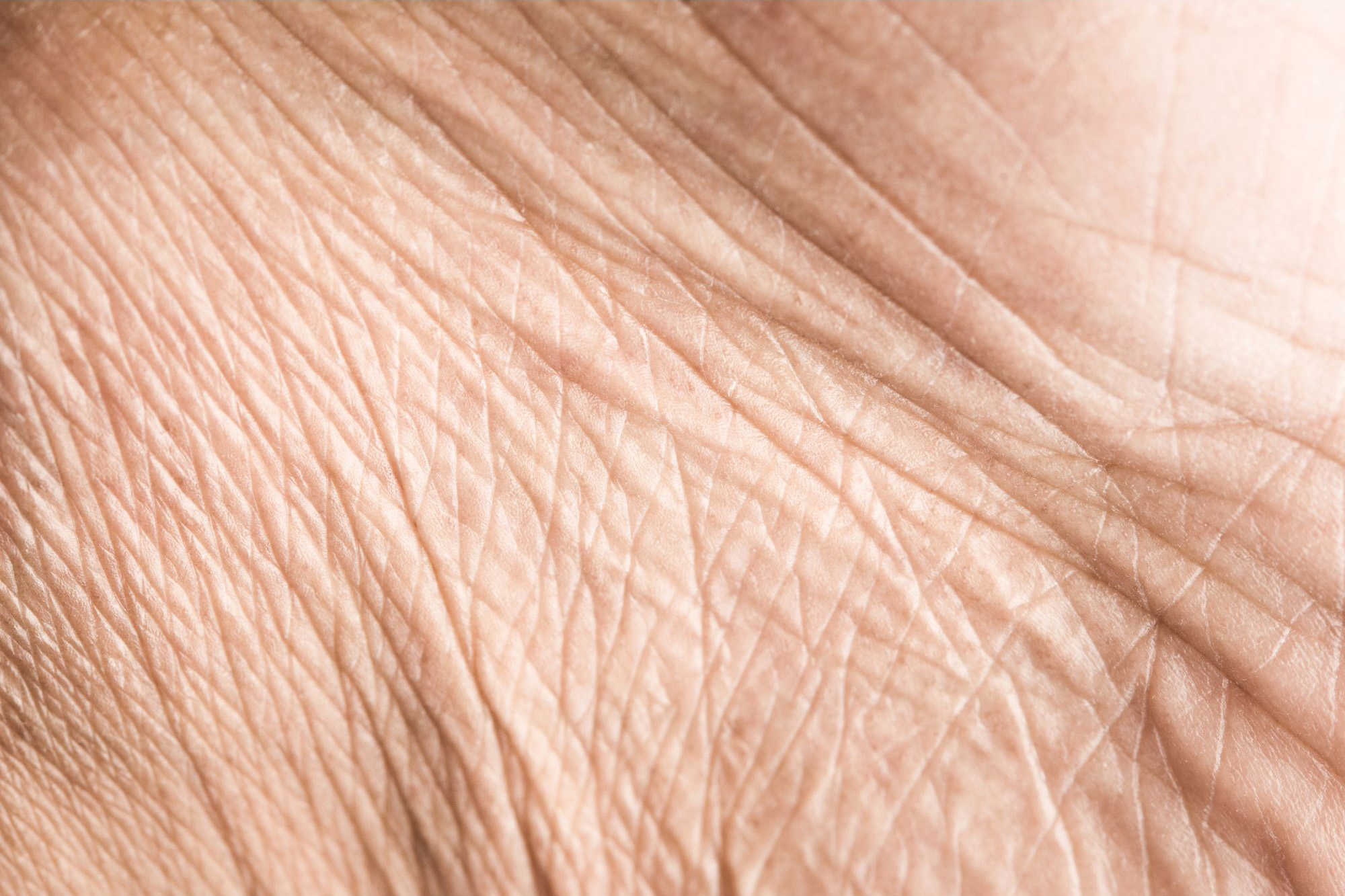 Wrinkled-Skin.jpg