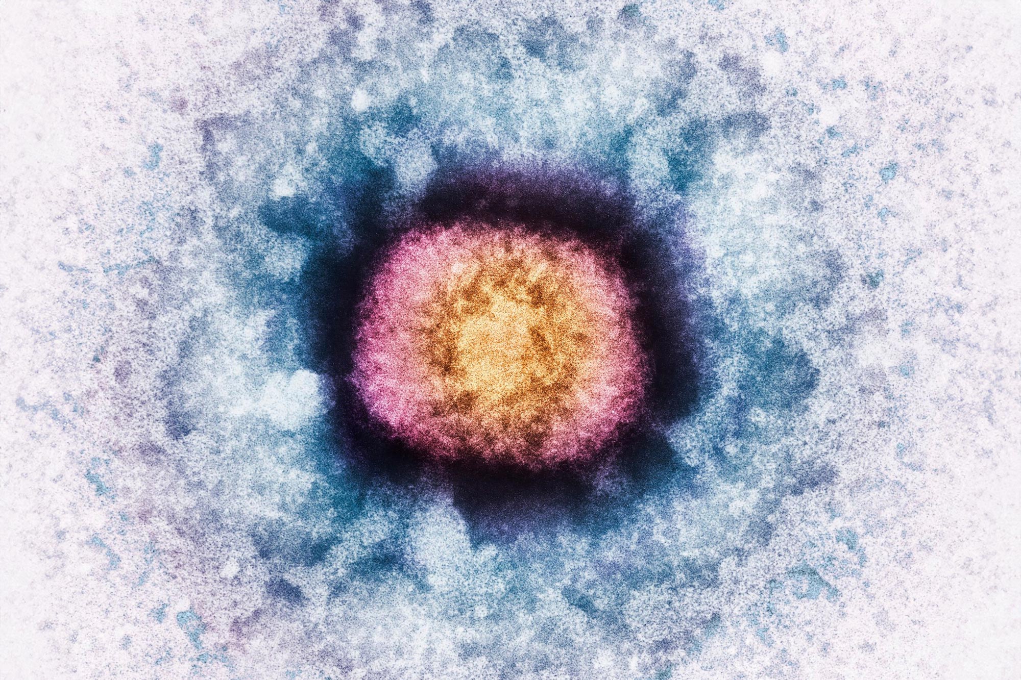 Vaccinia-Virus-Particle.jpg