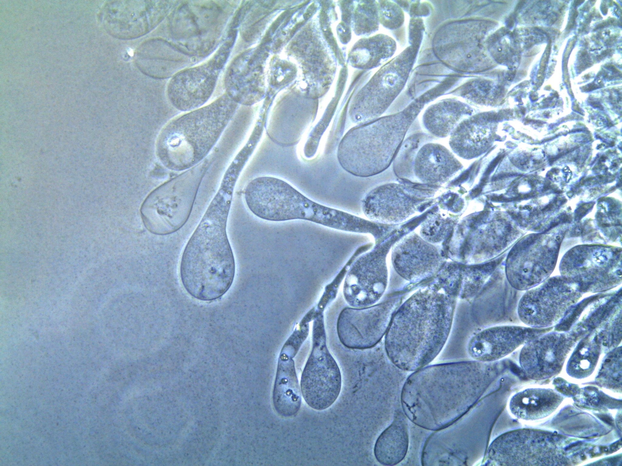 Magnified-Image-of-Nutritive-Vesicles-Produced-by-Ant-Cultivated-Fungus.jpg