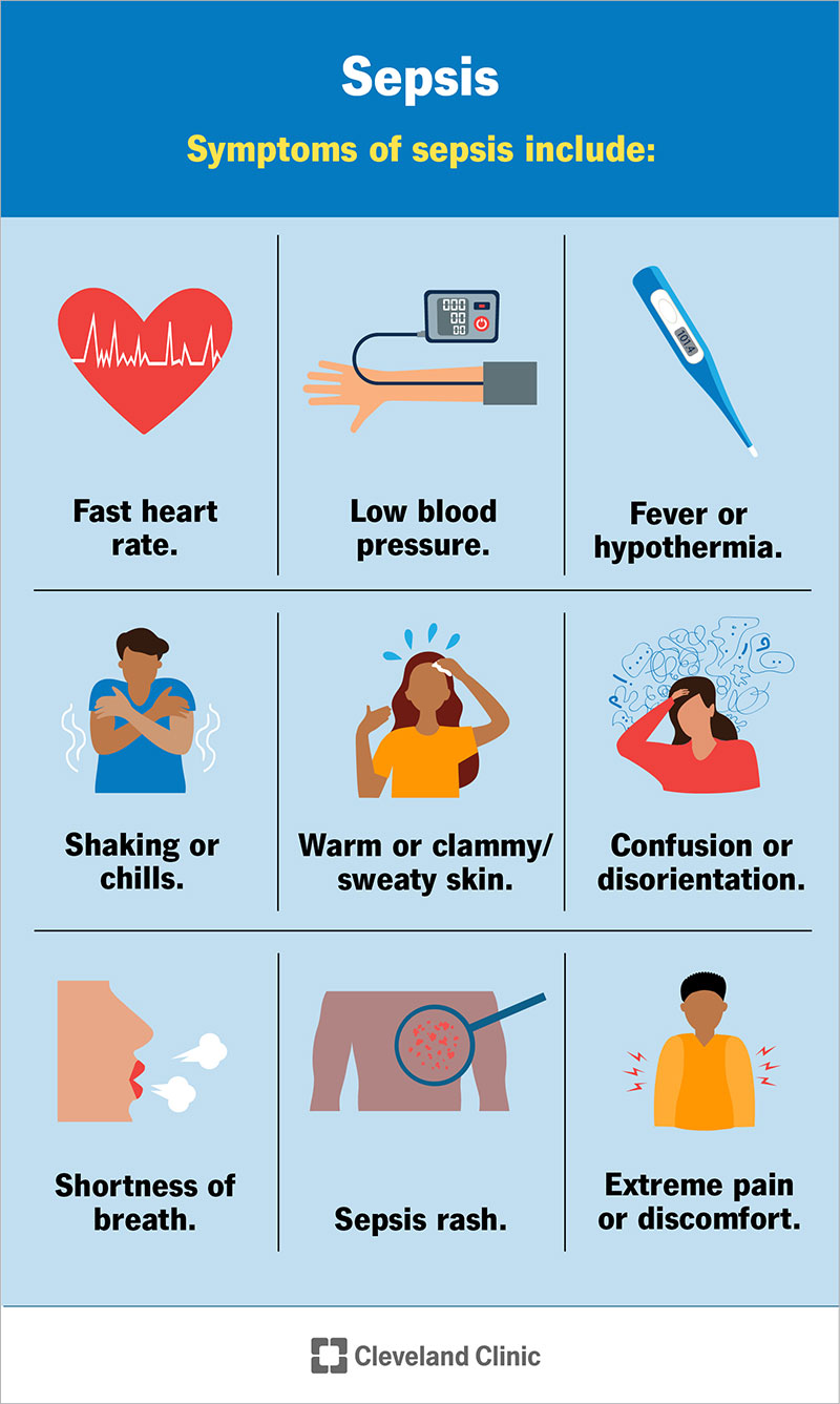 12361-sepsis.jpg