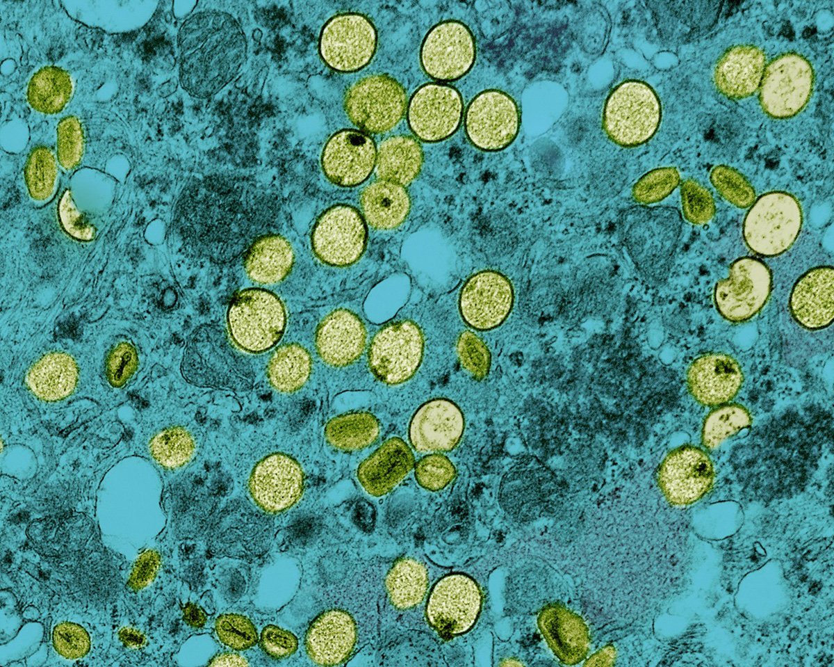Colorized-Transmission-Electron-Micrograph-of-Mpox-Virus-Particles-Found-Within-VERO-E6-Cells.jpg