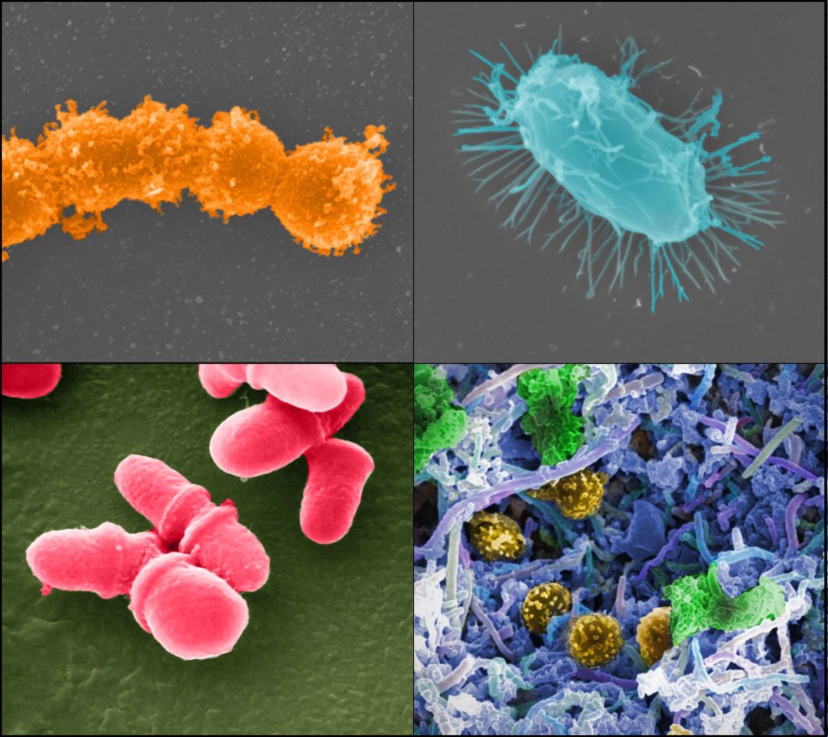 Bacteria-Collage-Human-Microbiome-Project.jpg