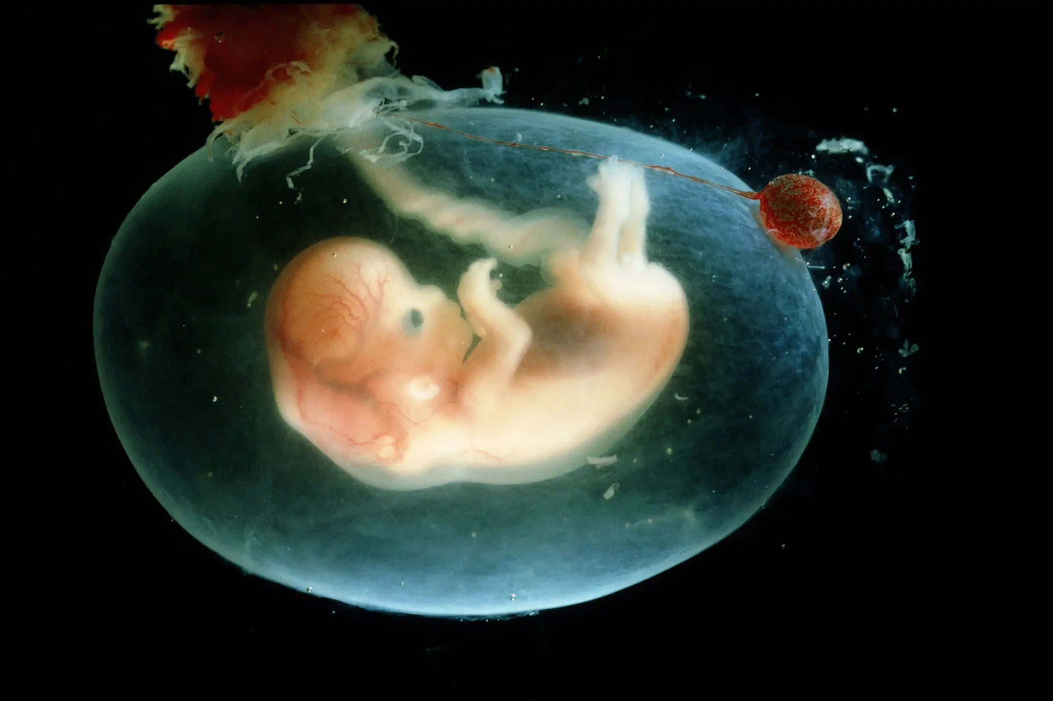 16-PREGNANCY-COSTS-superJumbo.webp